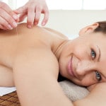 Kvinde ligger på briks og bliver behandlet med akupunktur